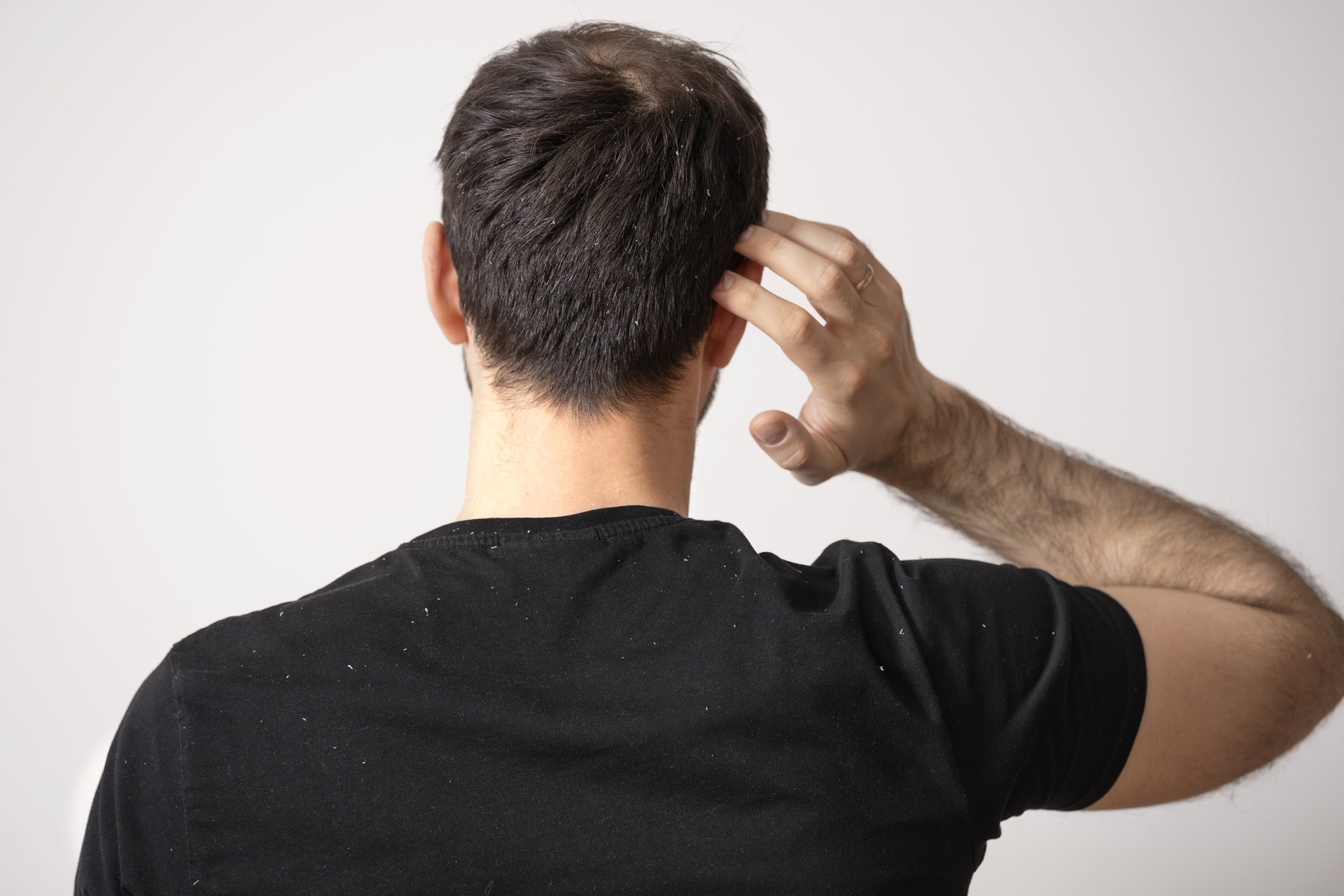 پرپشت کردن مو مردانه در 8 روش