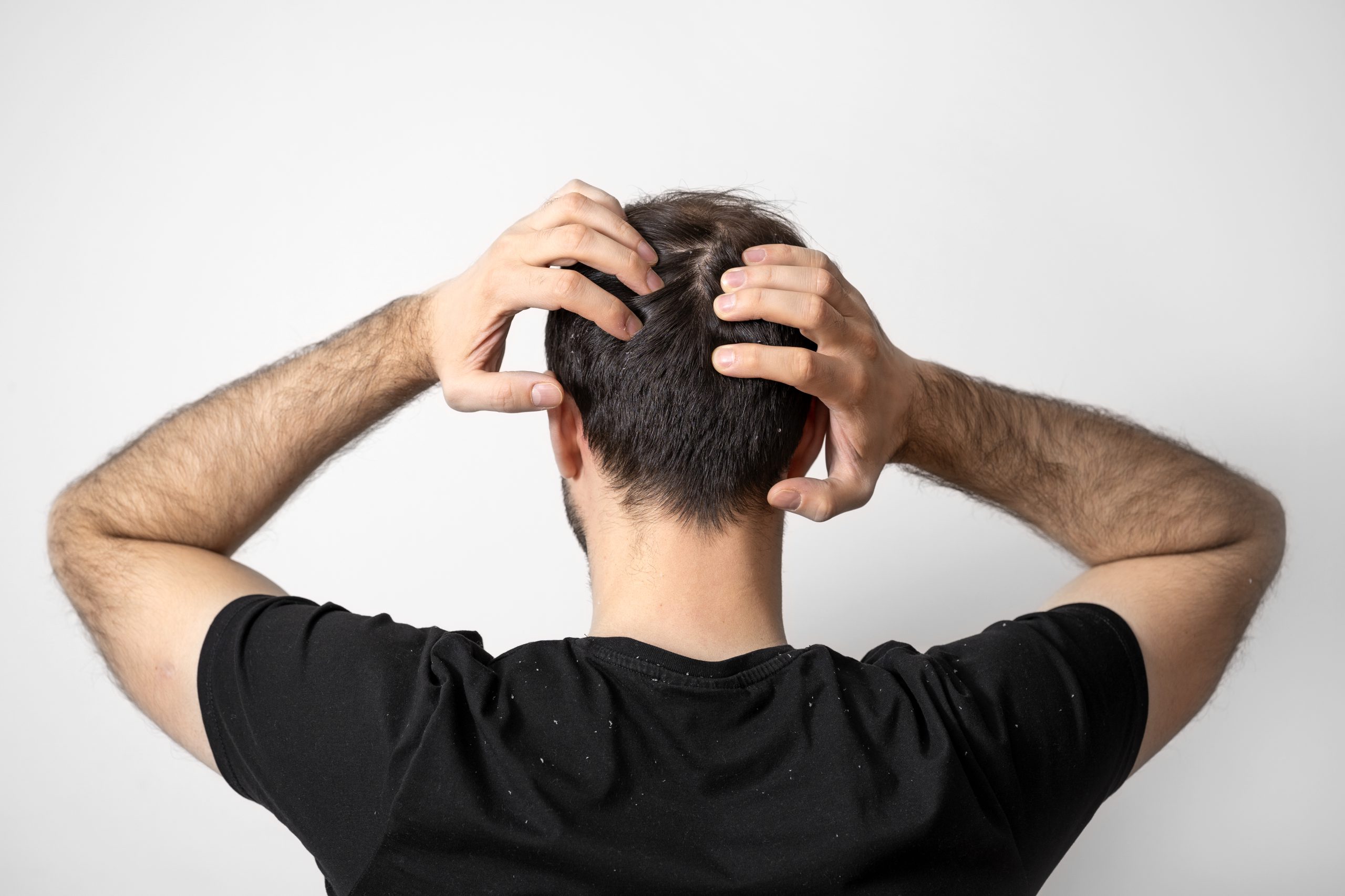 پرپشت کردن مو مردانه در 8 روش